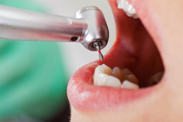 Best Urgent Tooth Repair  in Fort Irwin, CA